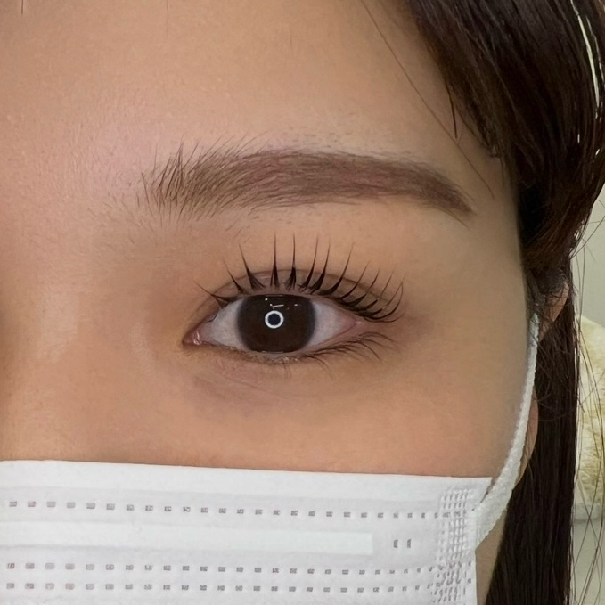 rino_eye