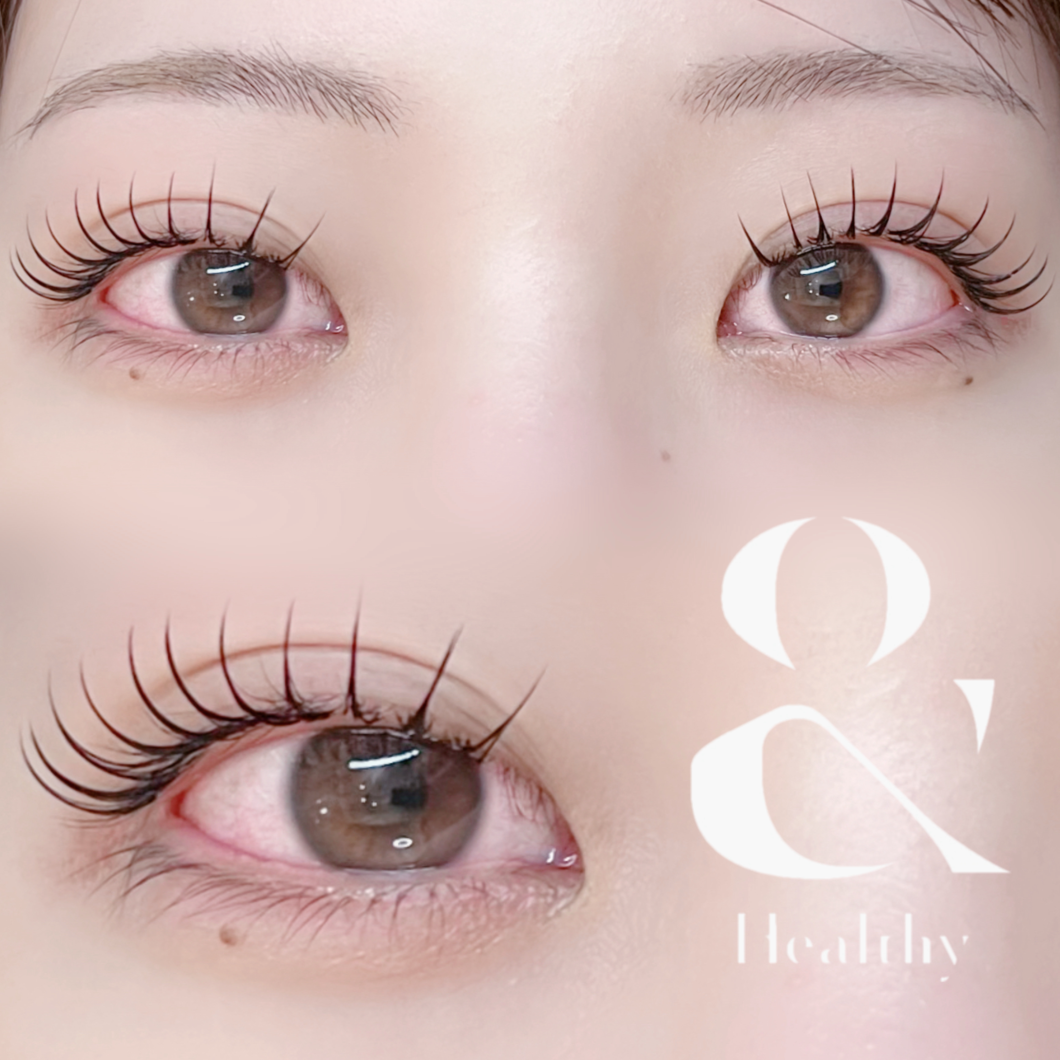 hrm_eye