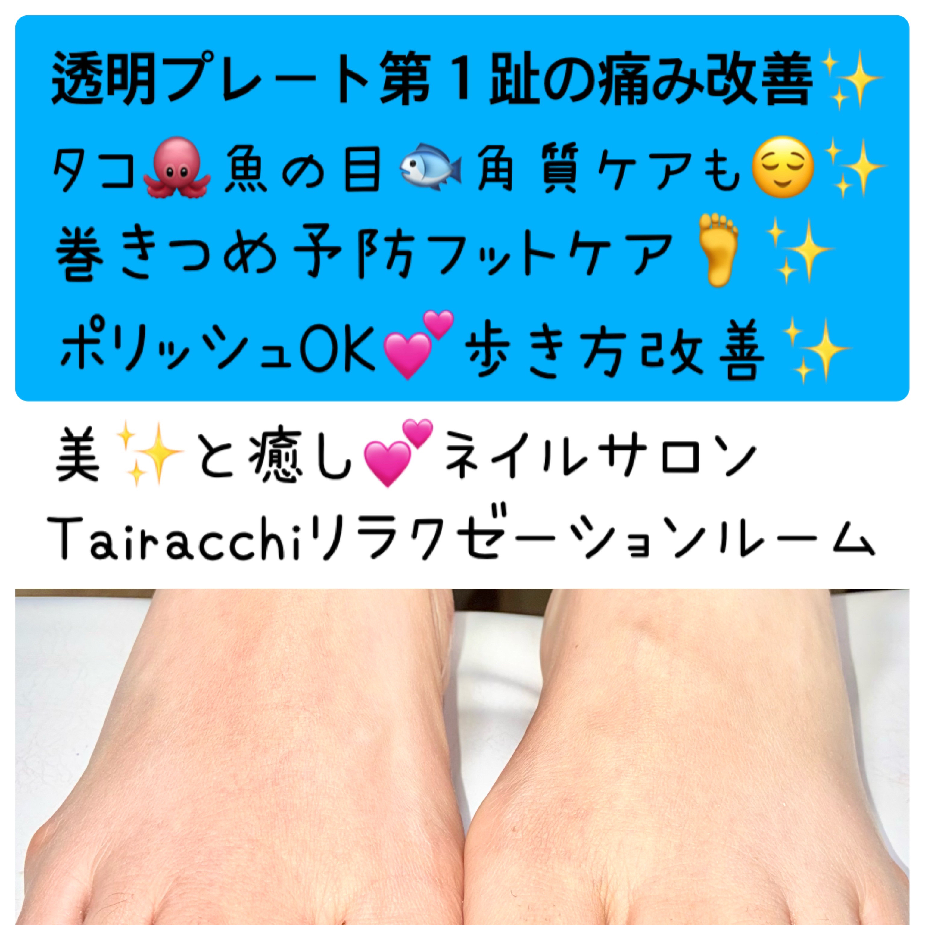 Tairacch_