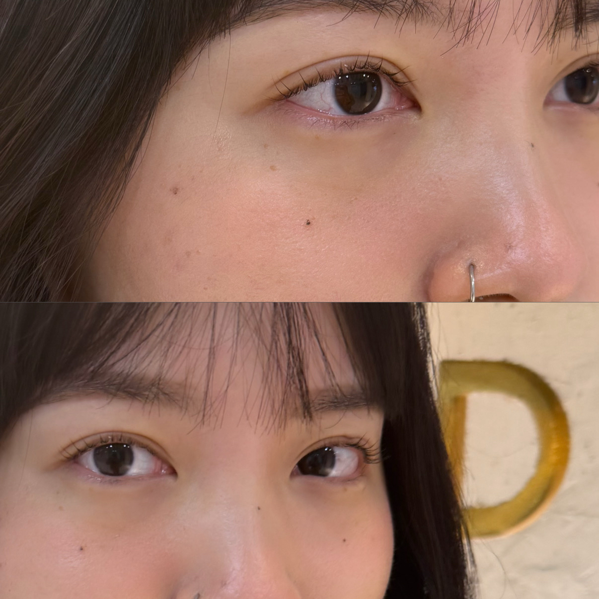 reimtm__eye