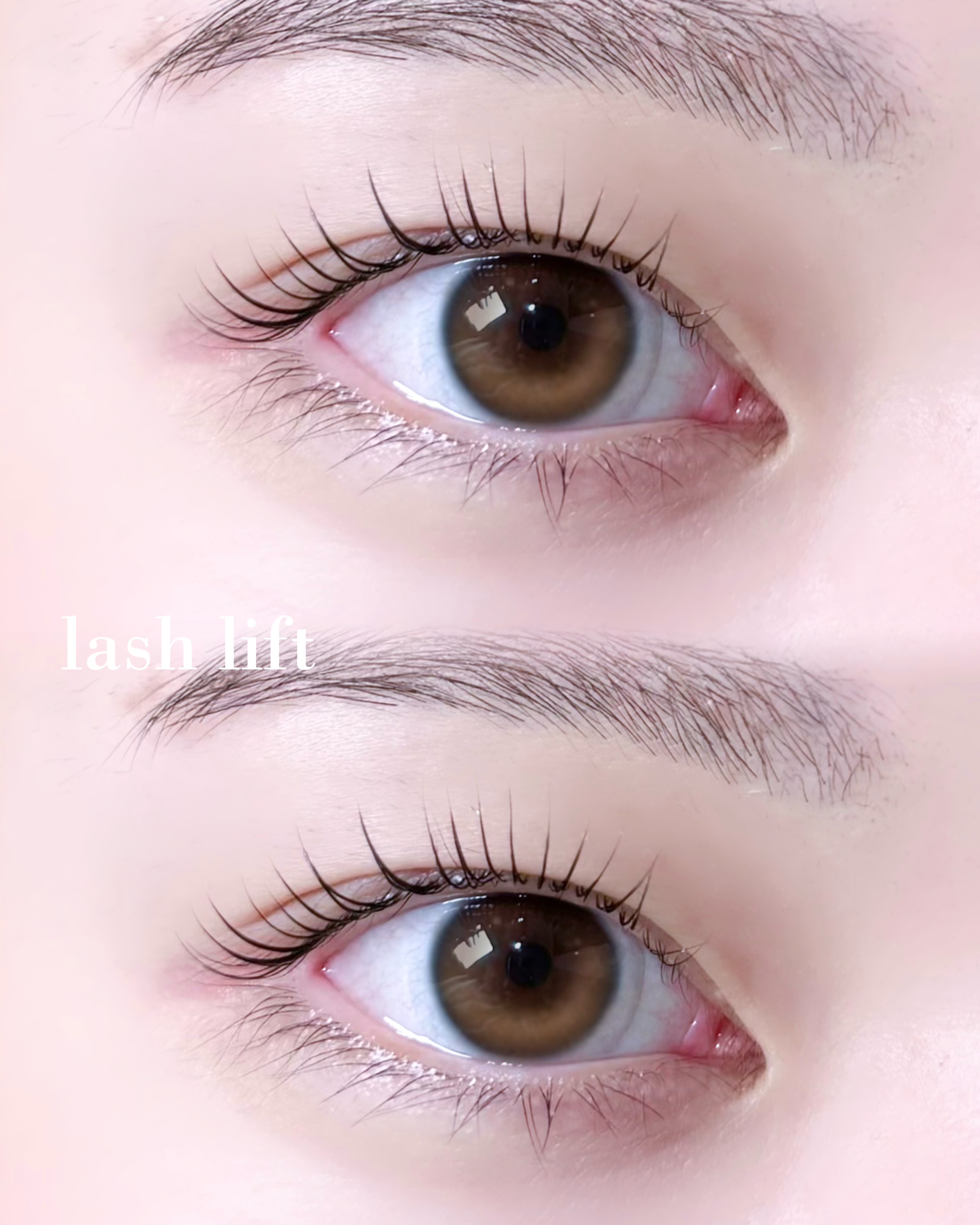 MEI_eye