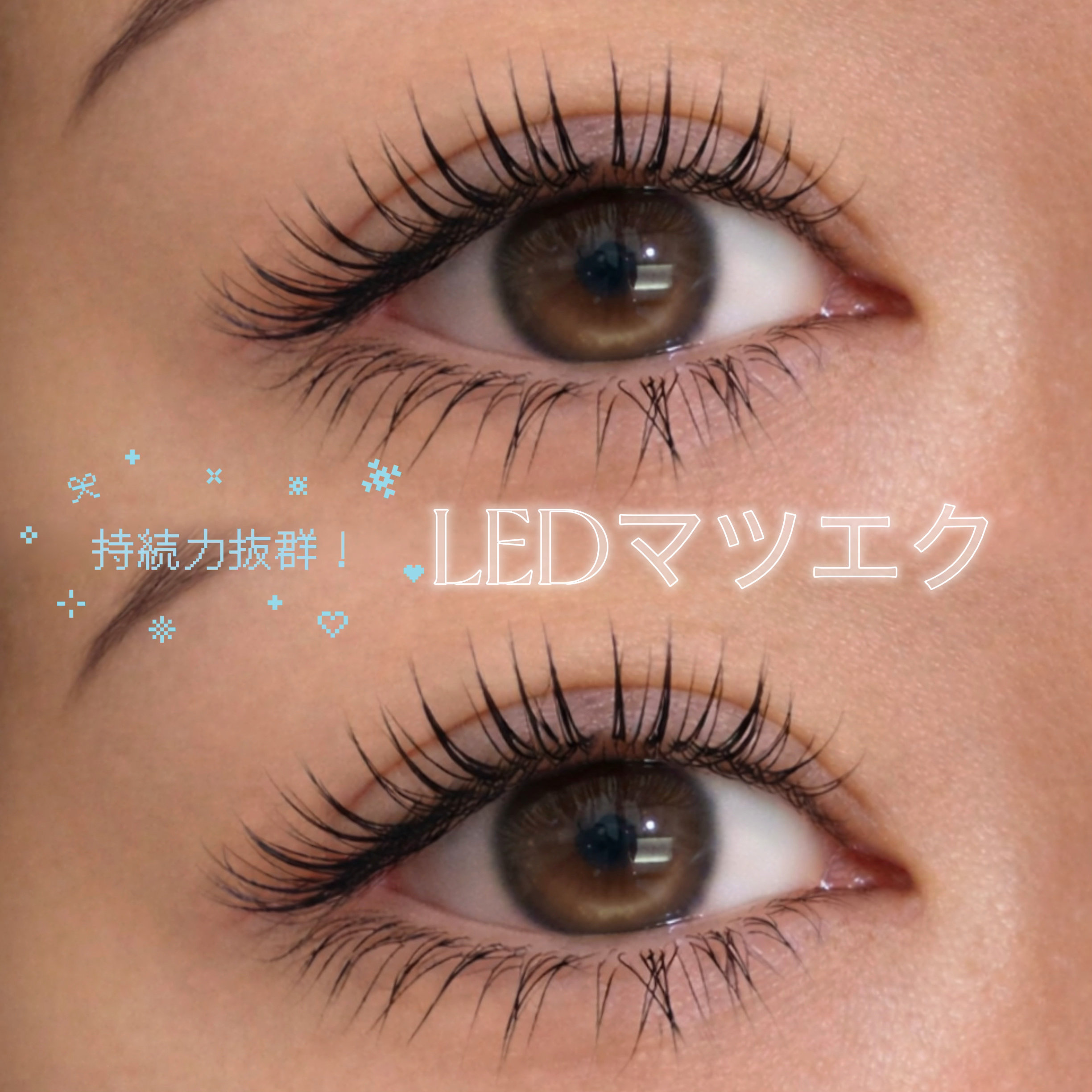 eye___n.t.k