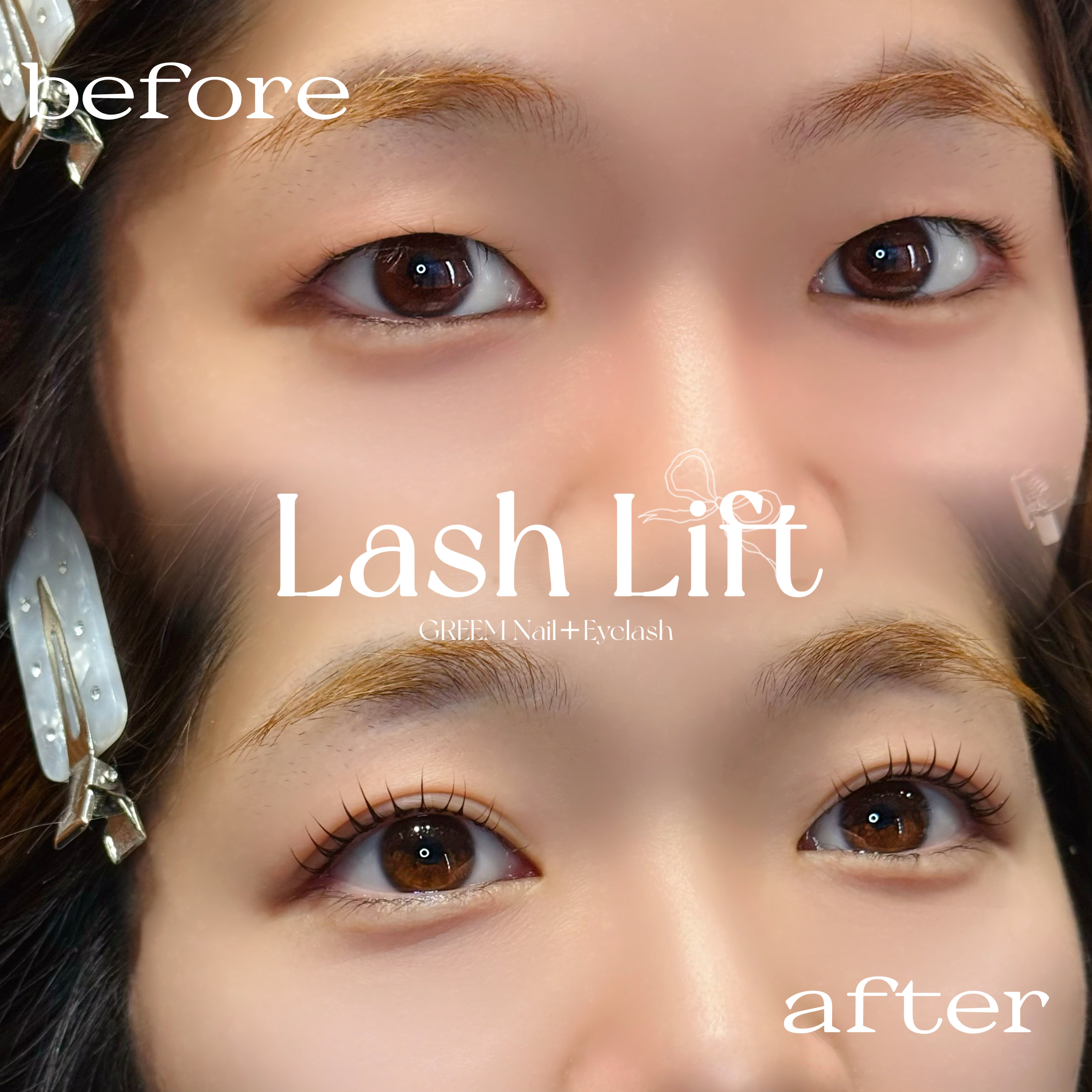 eyelist__chiho