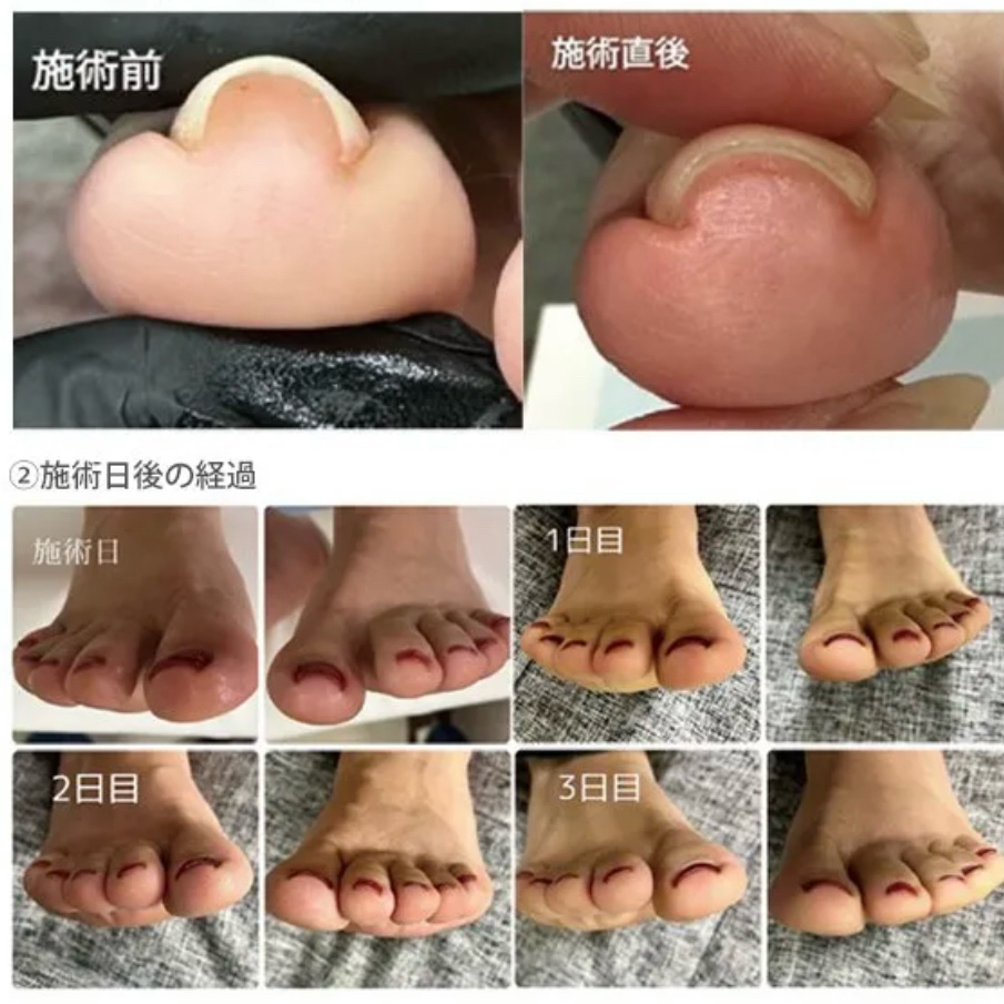 Lilly_nailsalon_Miku