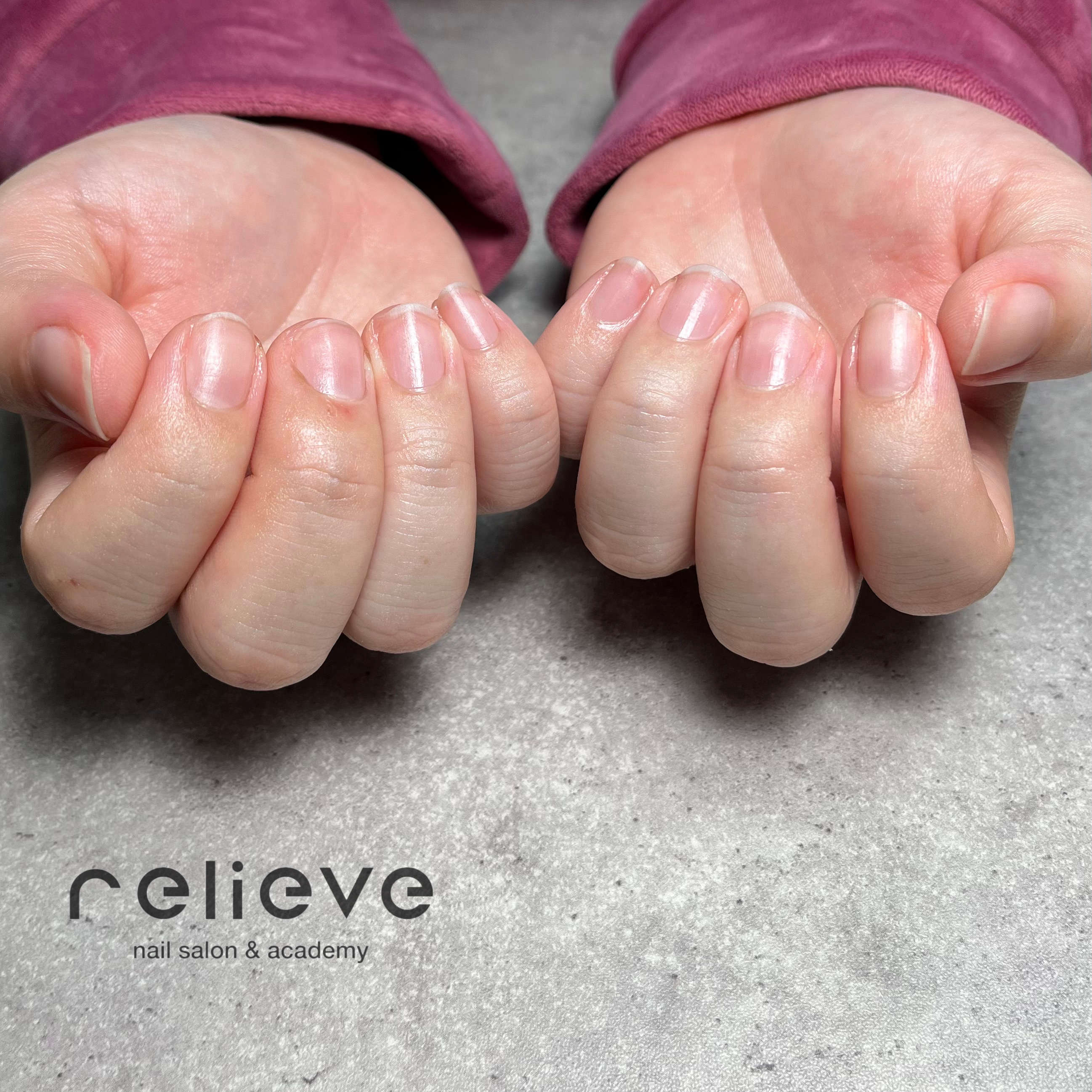 relieve