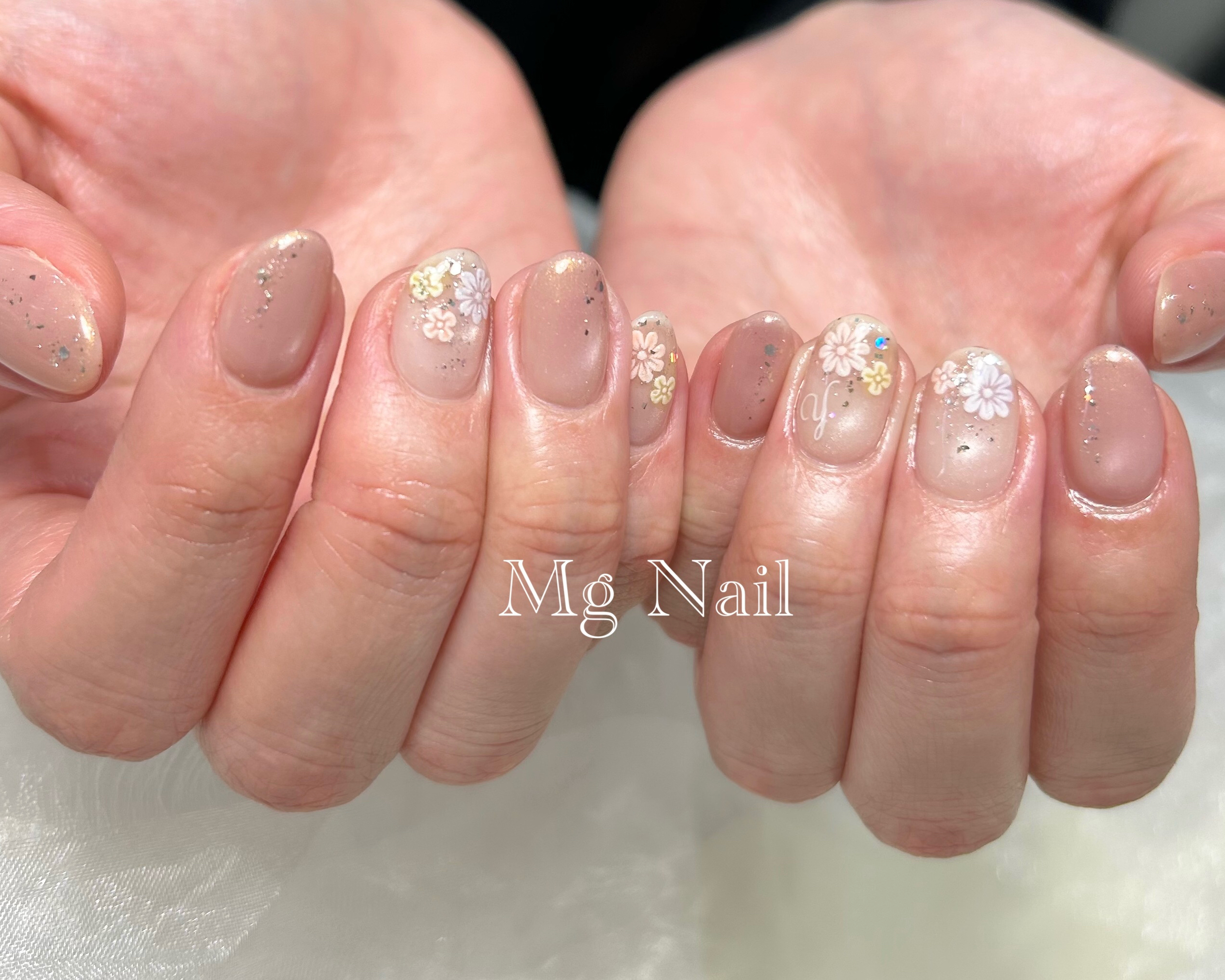Mg_Nail_