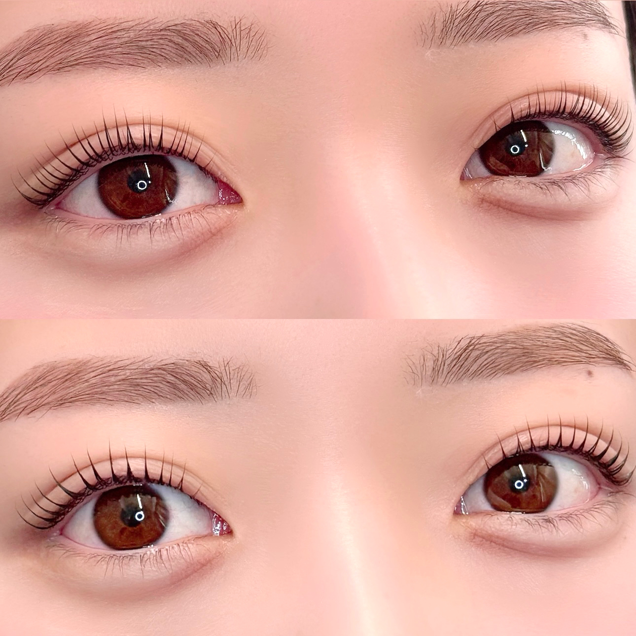 na_eye_