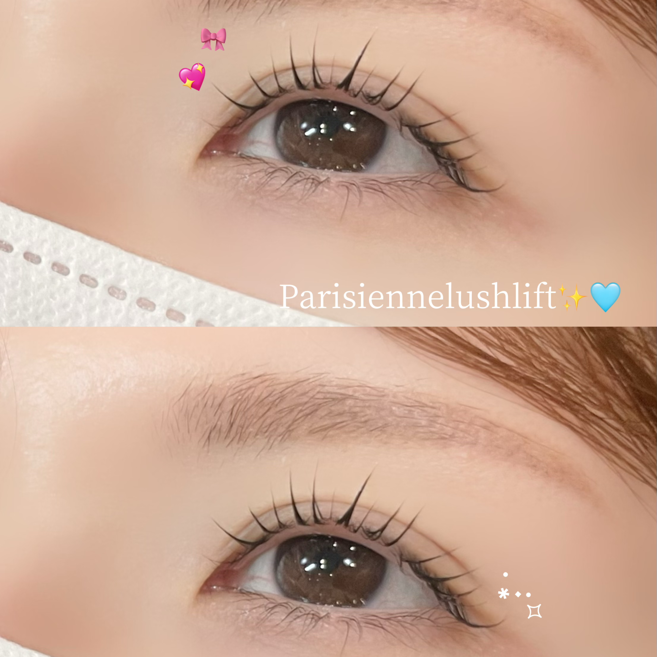 miina_trueye