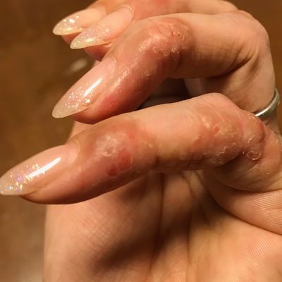 【アレルギー対応】諦めないで✨成分厳選ジェルで楽しむ大人の艶ネイル💅🏻