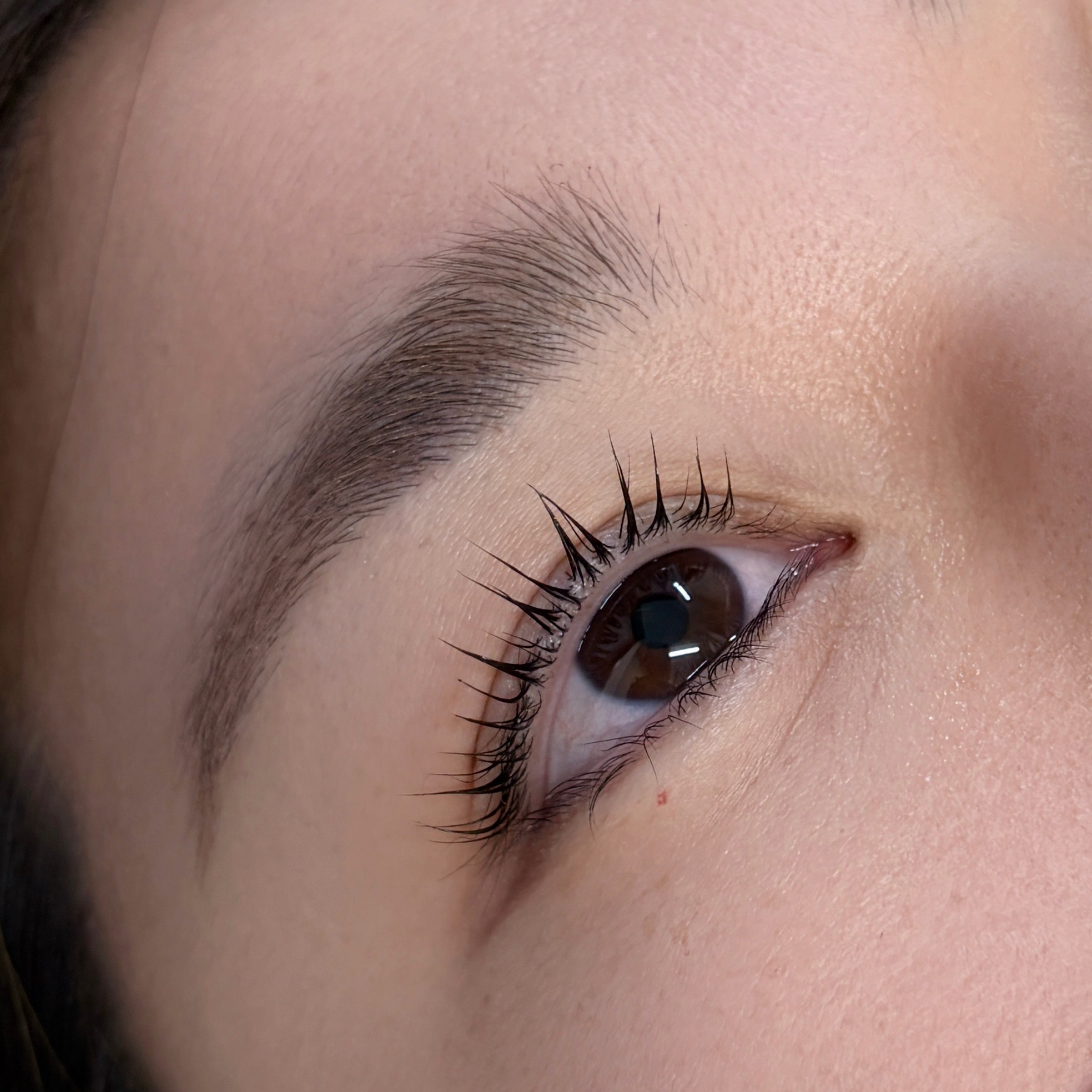 aoi__trueye