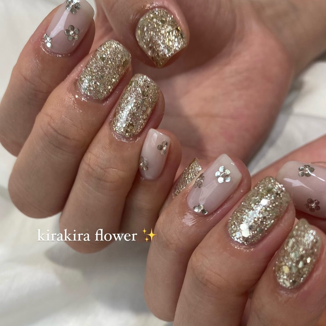 miRAN_nail