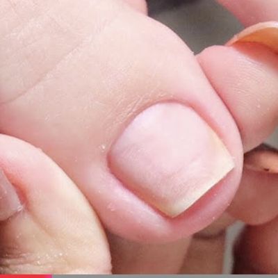foot ( オフのみ)