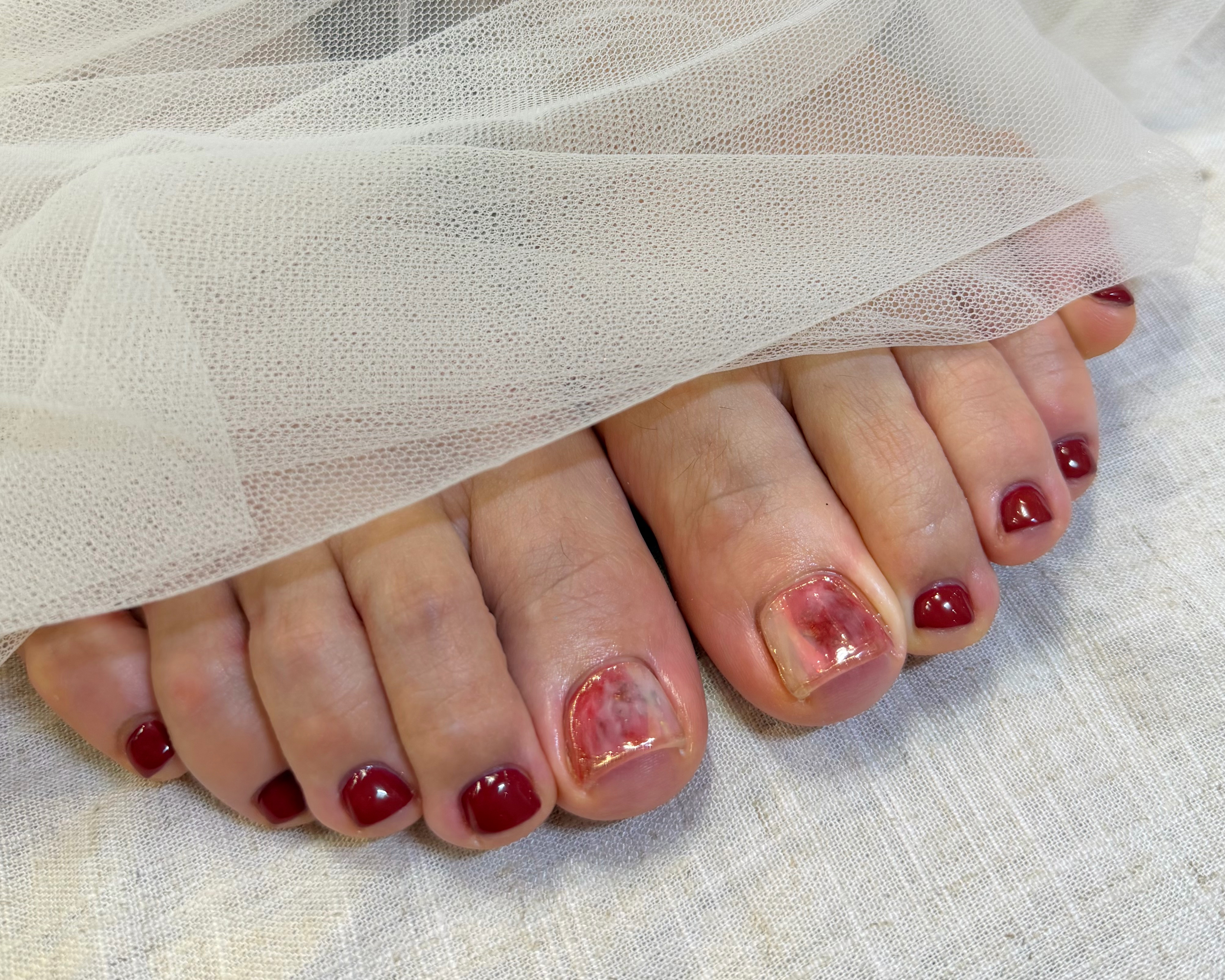 Ammynail