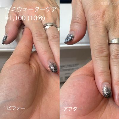 セミウォーターケア