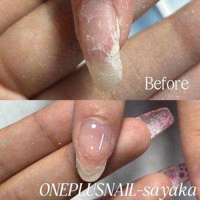 【モデル募集】補強のみ