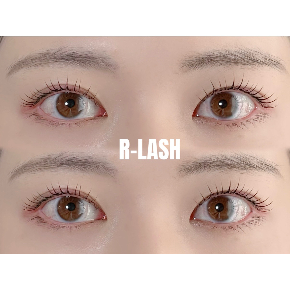 R_LASH