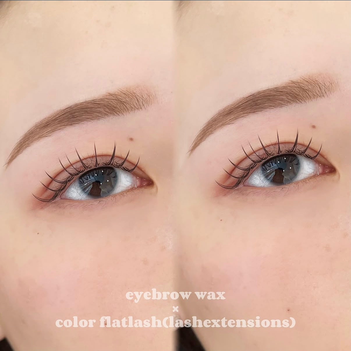 reimtm__eye