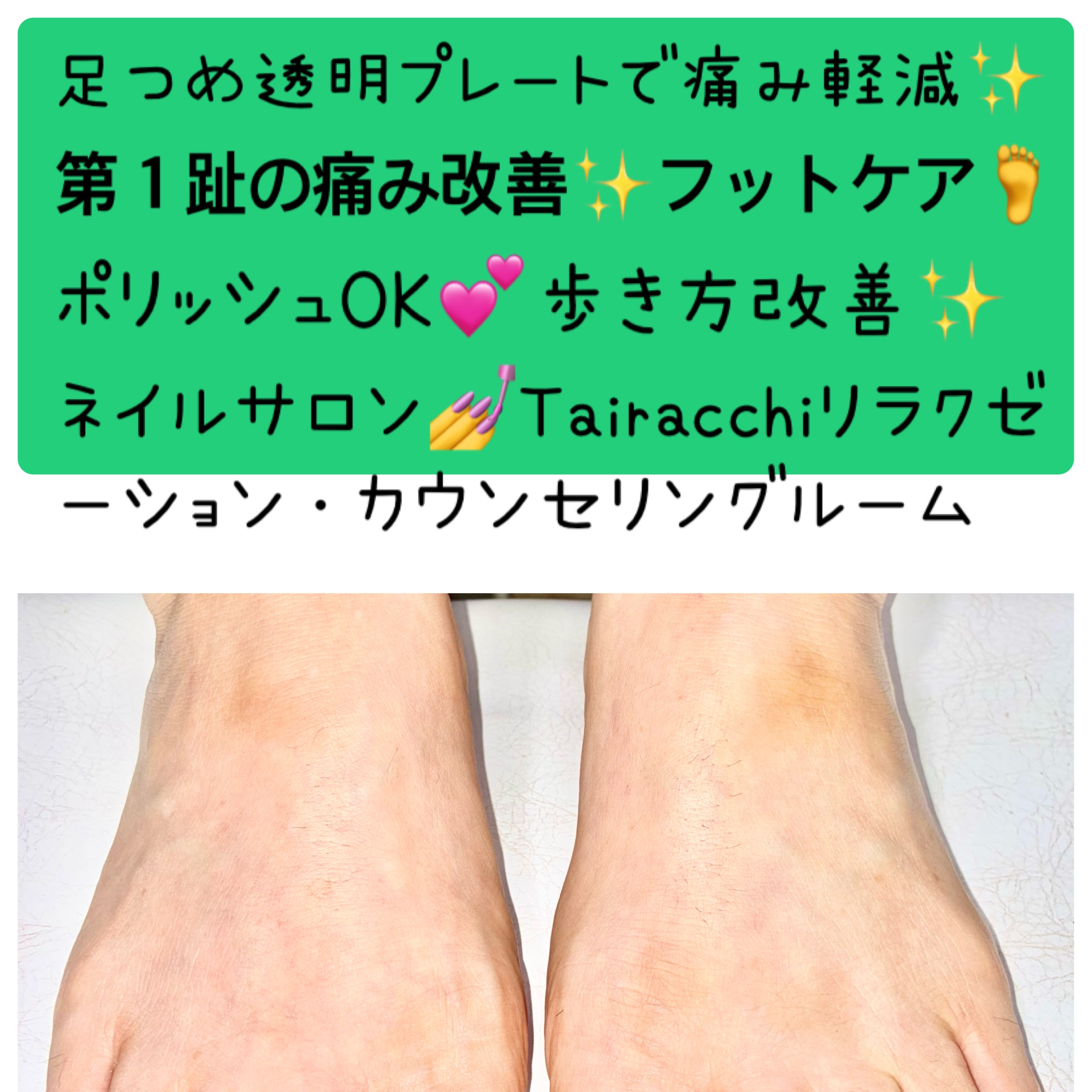 Tairacch_