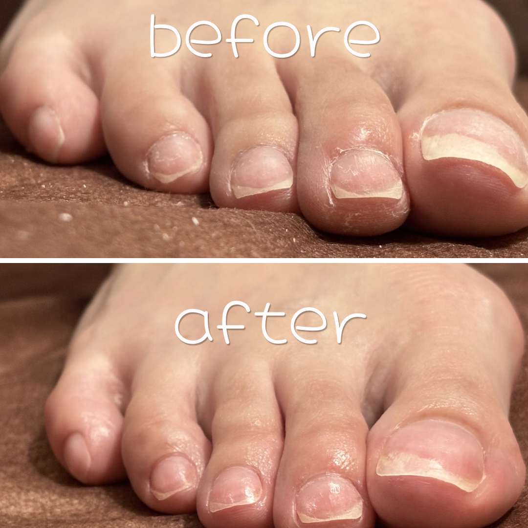 anon_nail