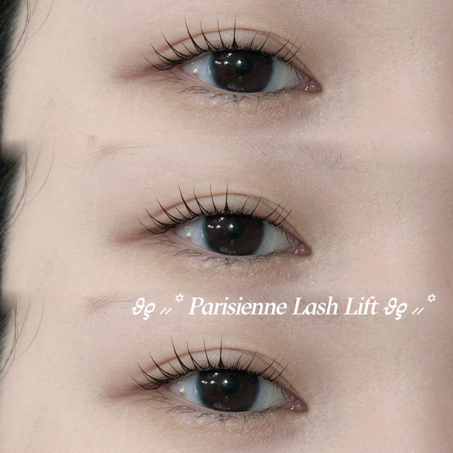 mio_trueye