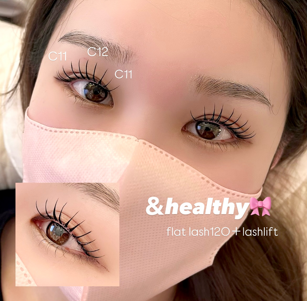 airi_trueye