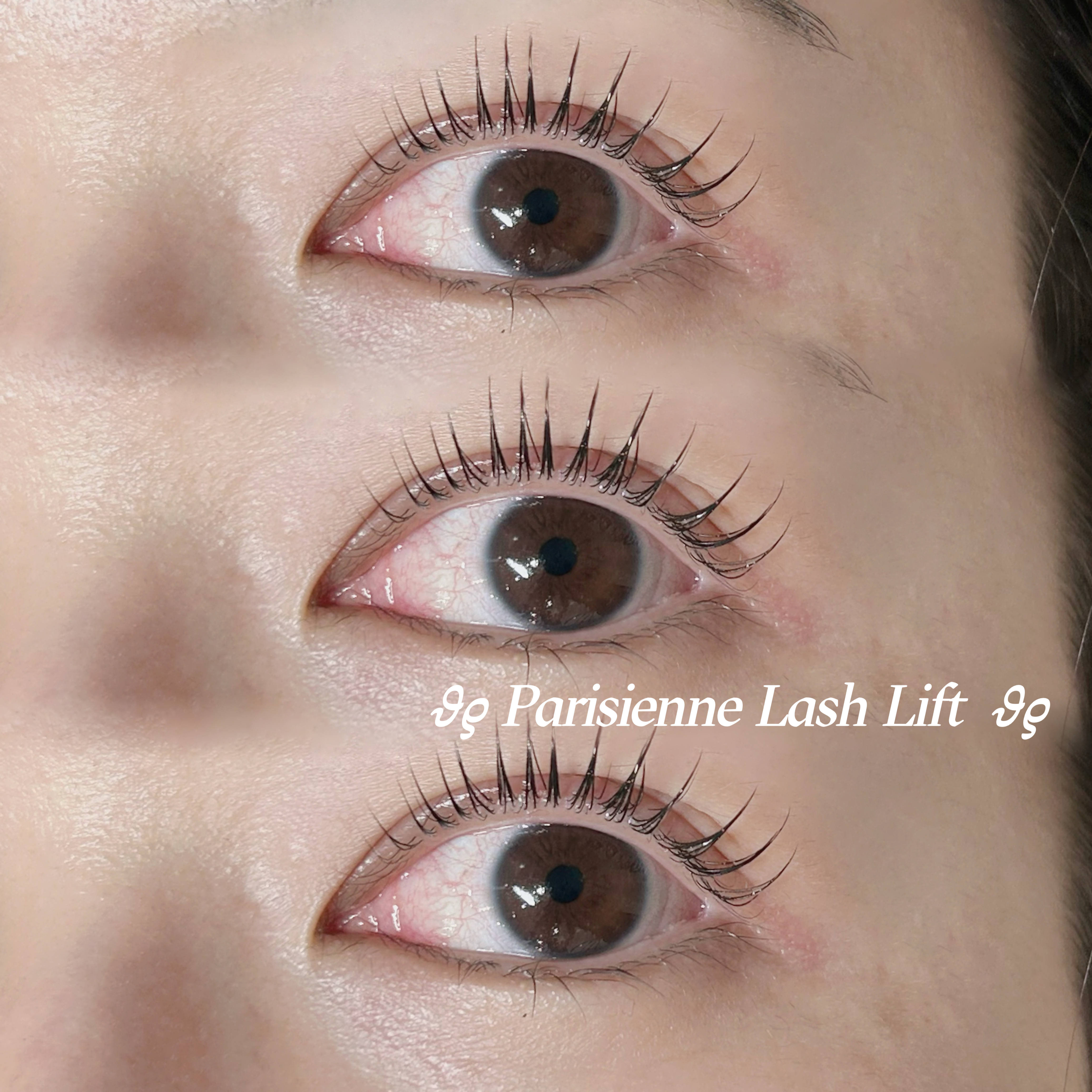 mio_trueye