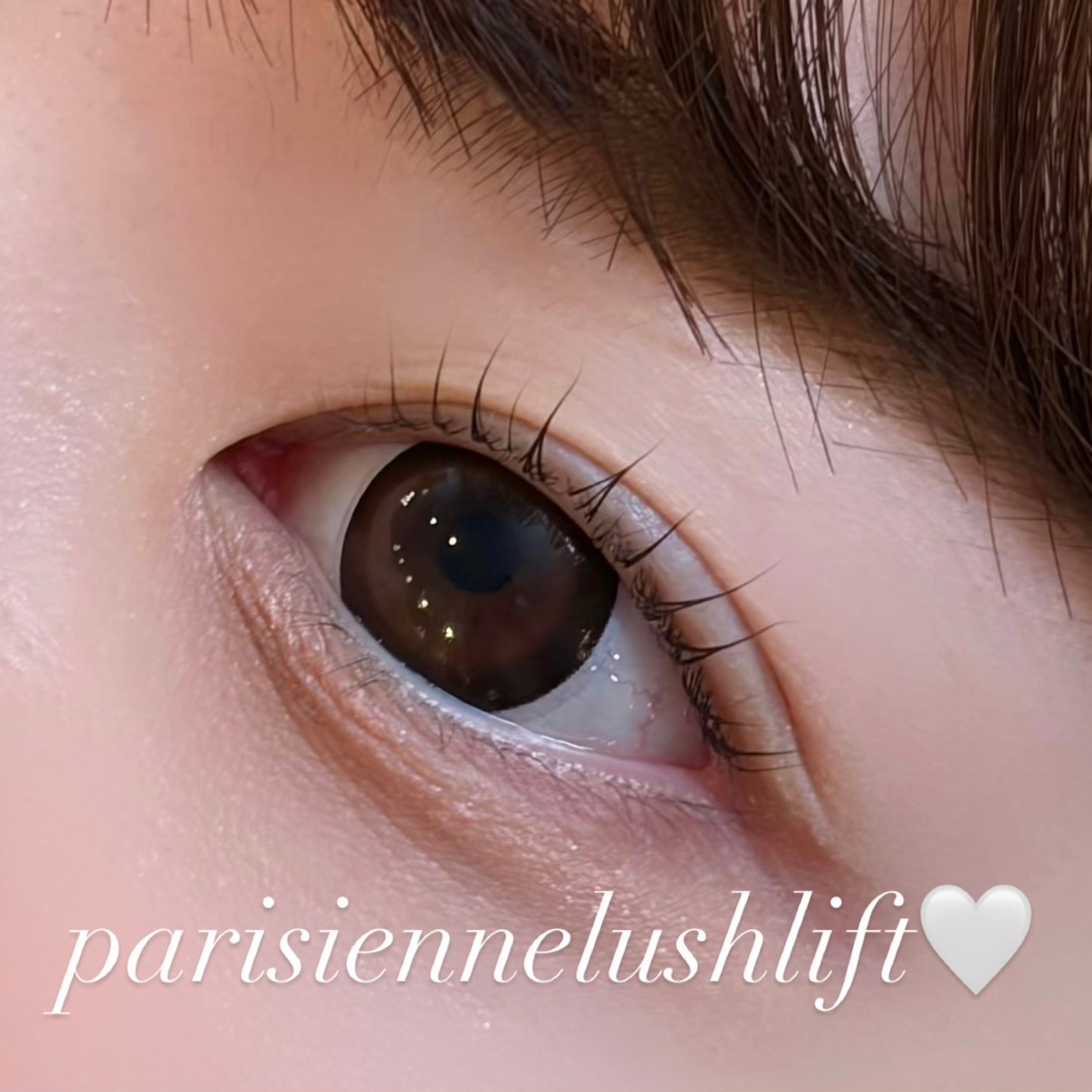 runa._trueye