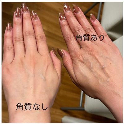 ハンドケア(ソフトピーリング)