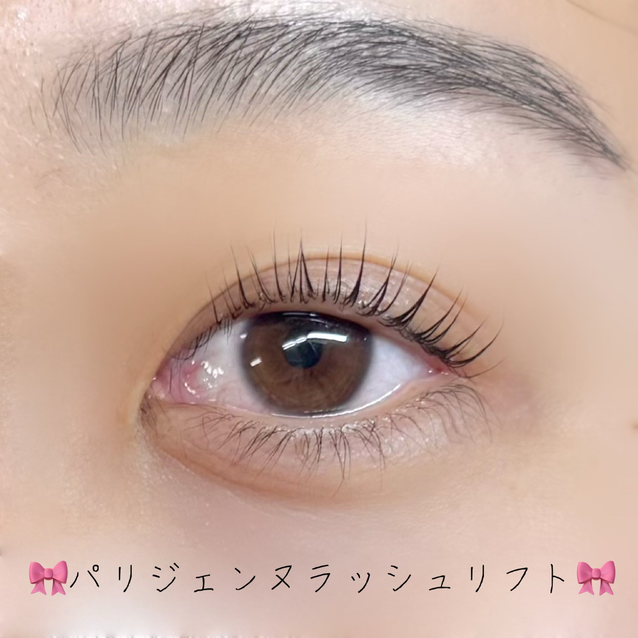 hinata_trueye