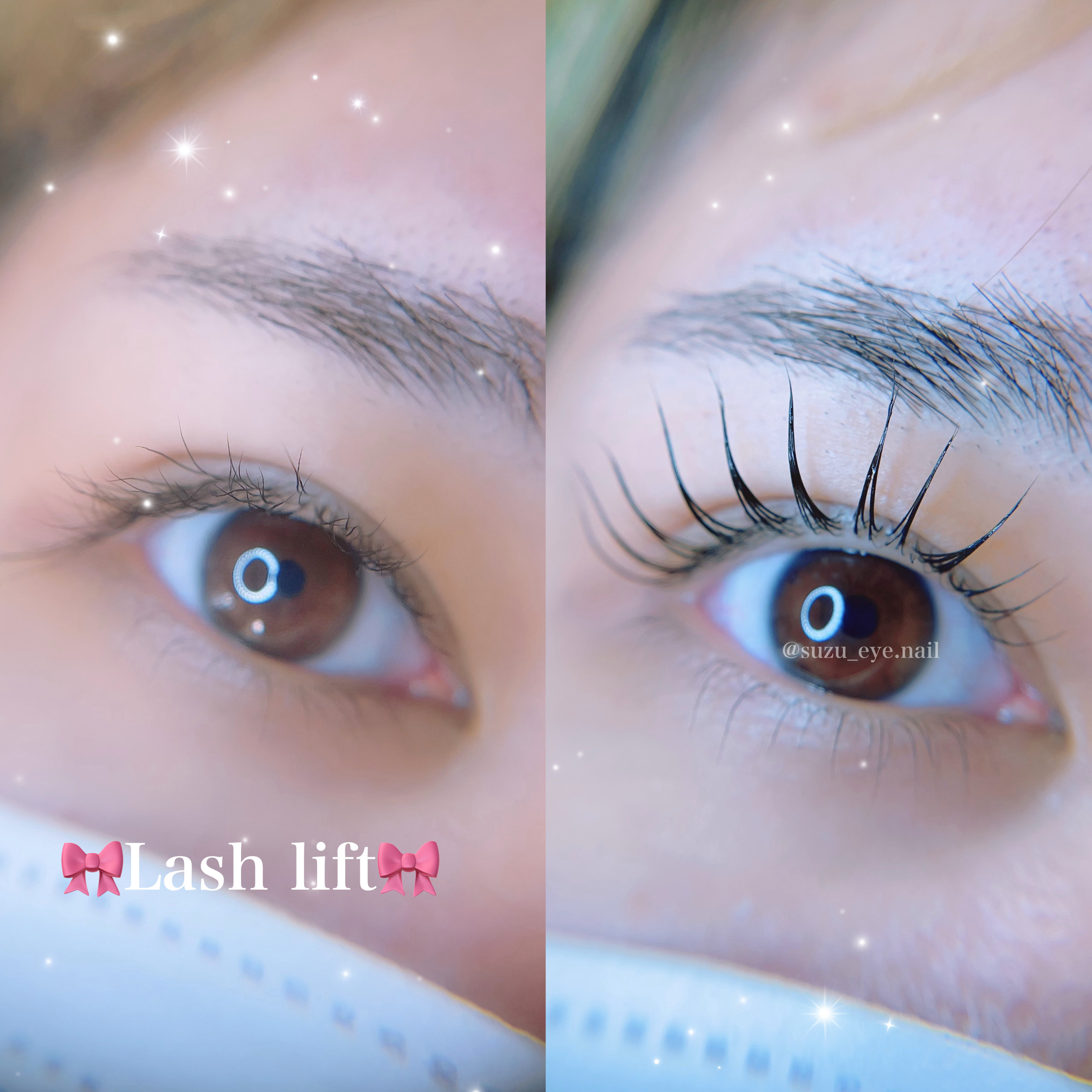 eye_su