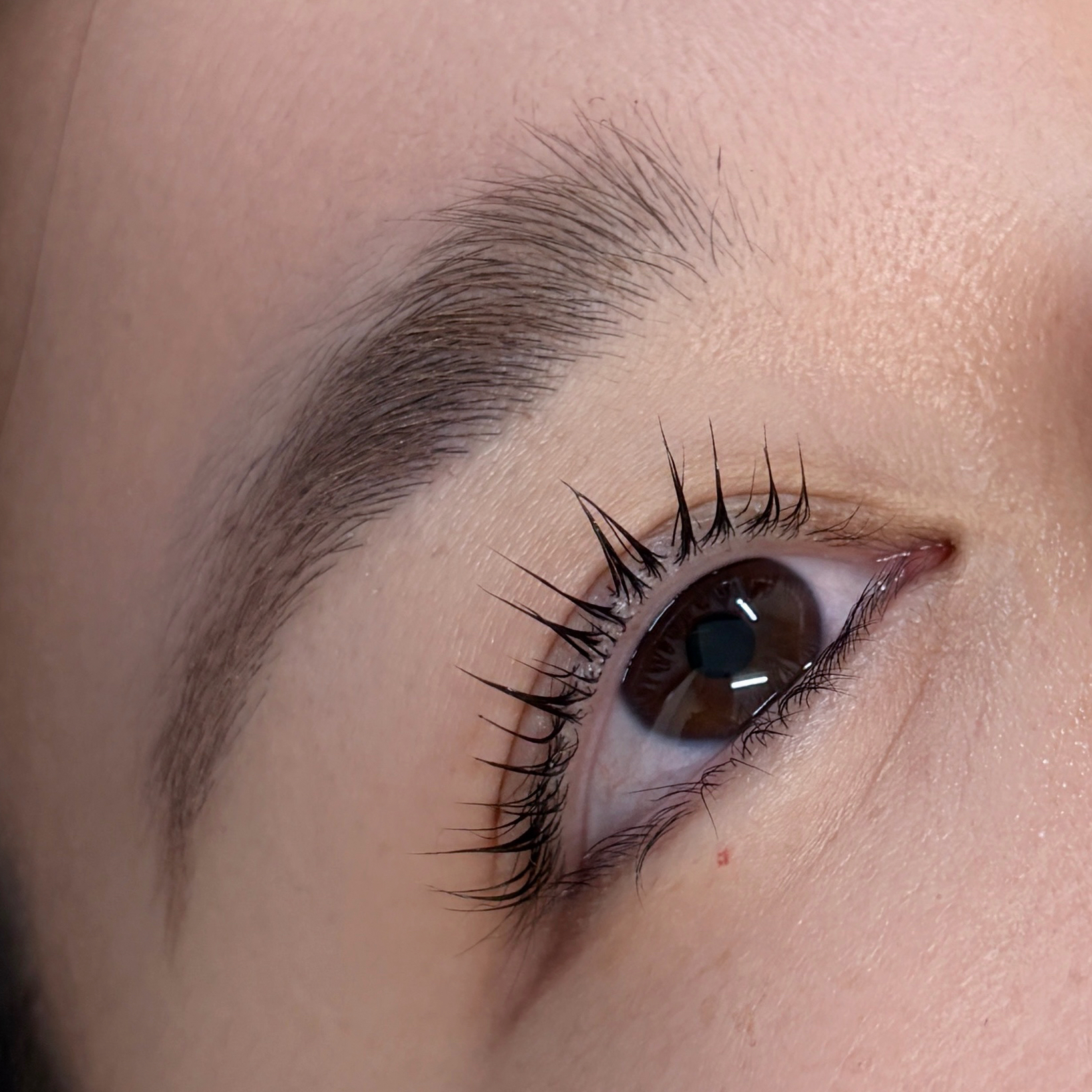 aoi__trueye