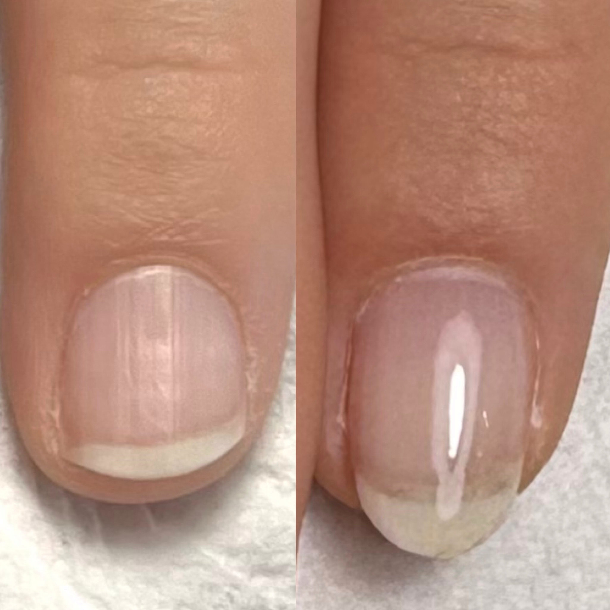 Lino_nail.masami