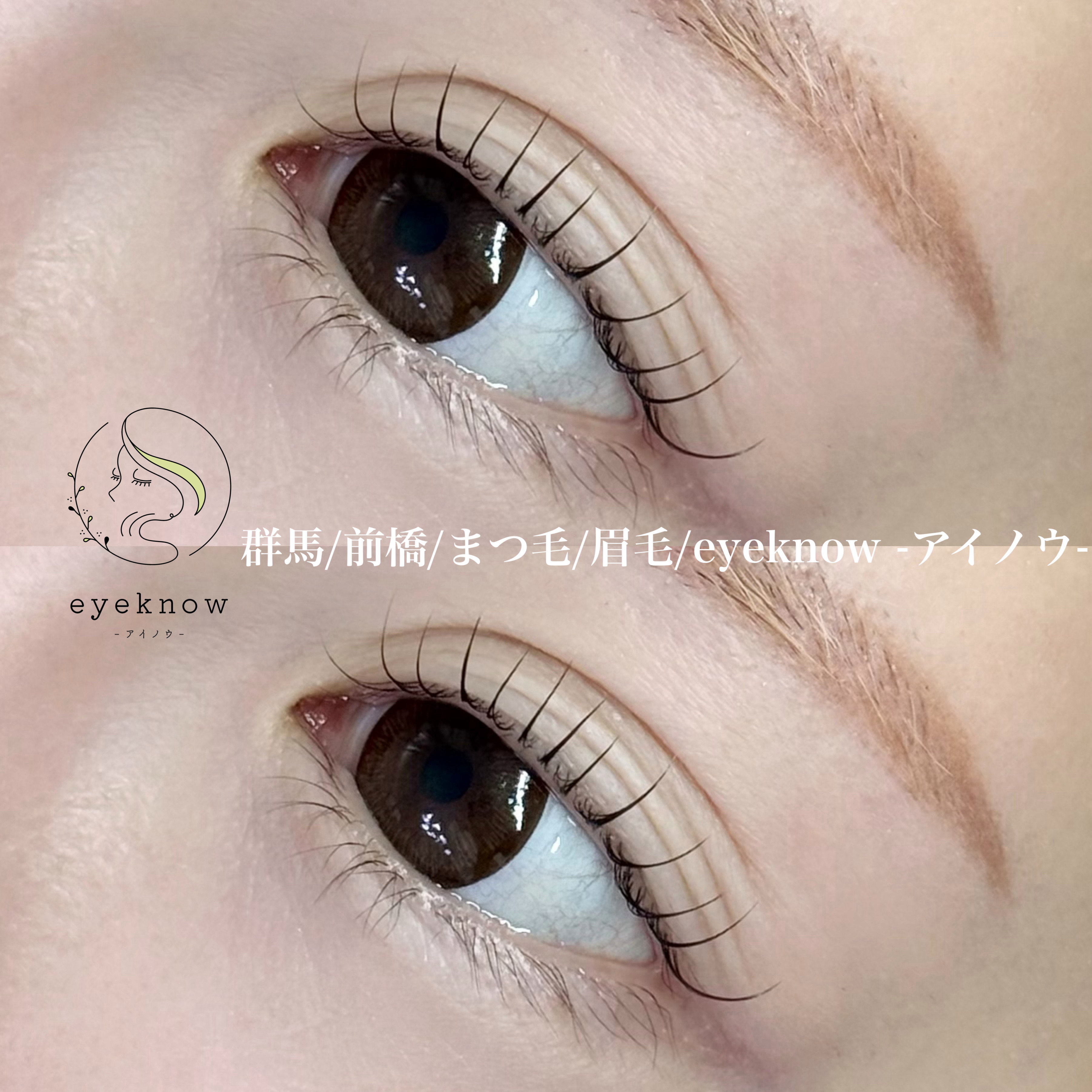 eyeknow
