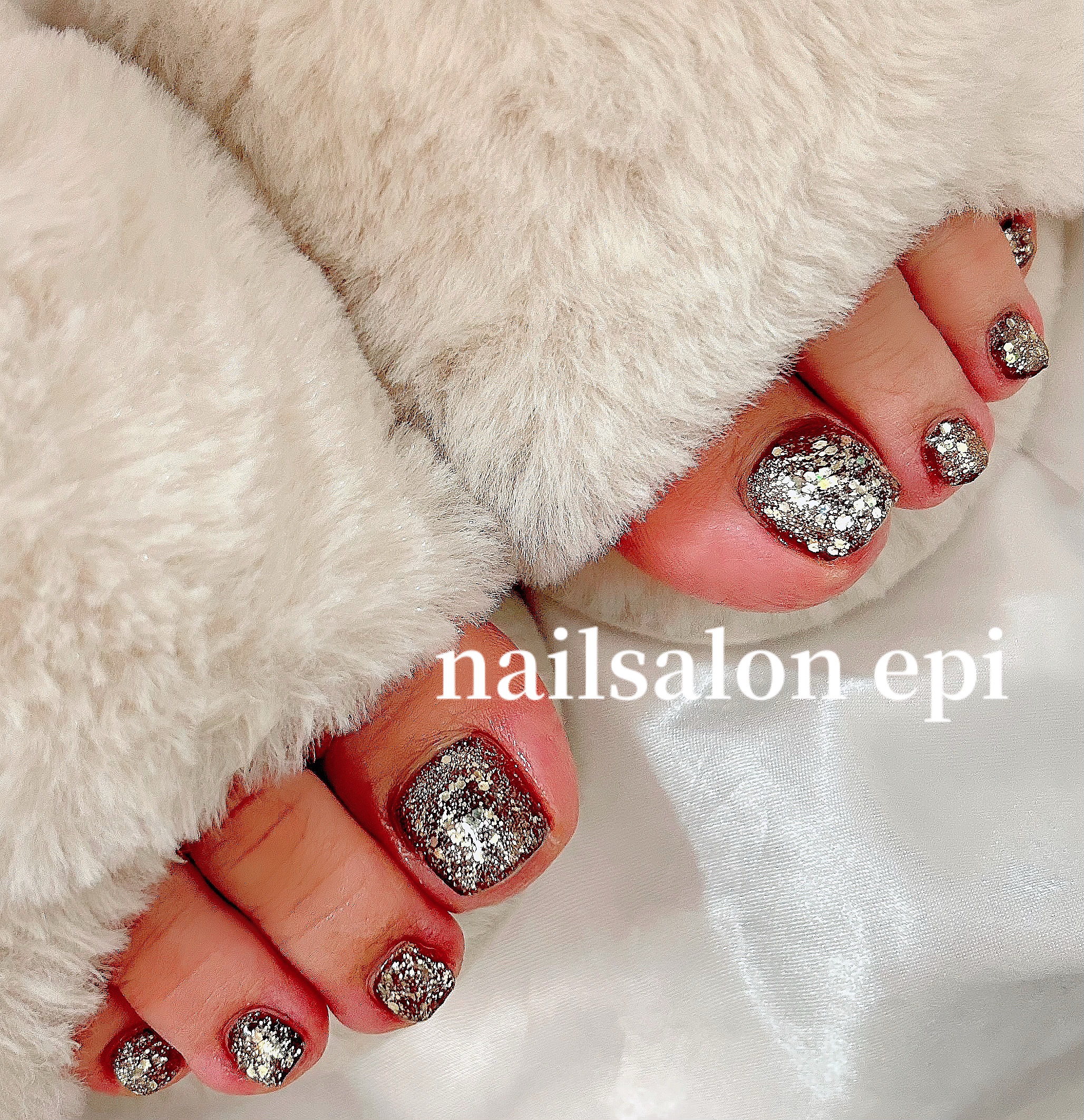 nail.epi