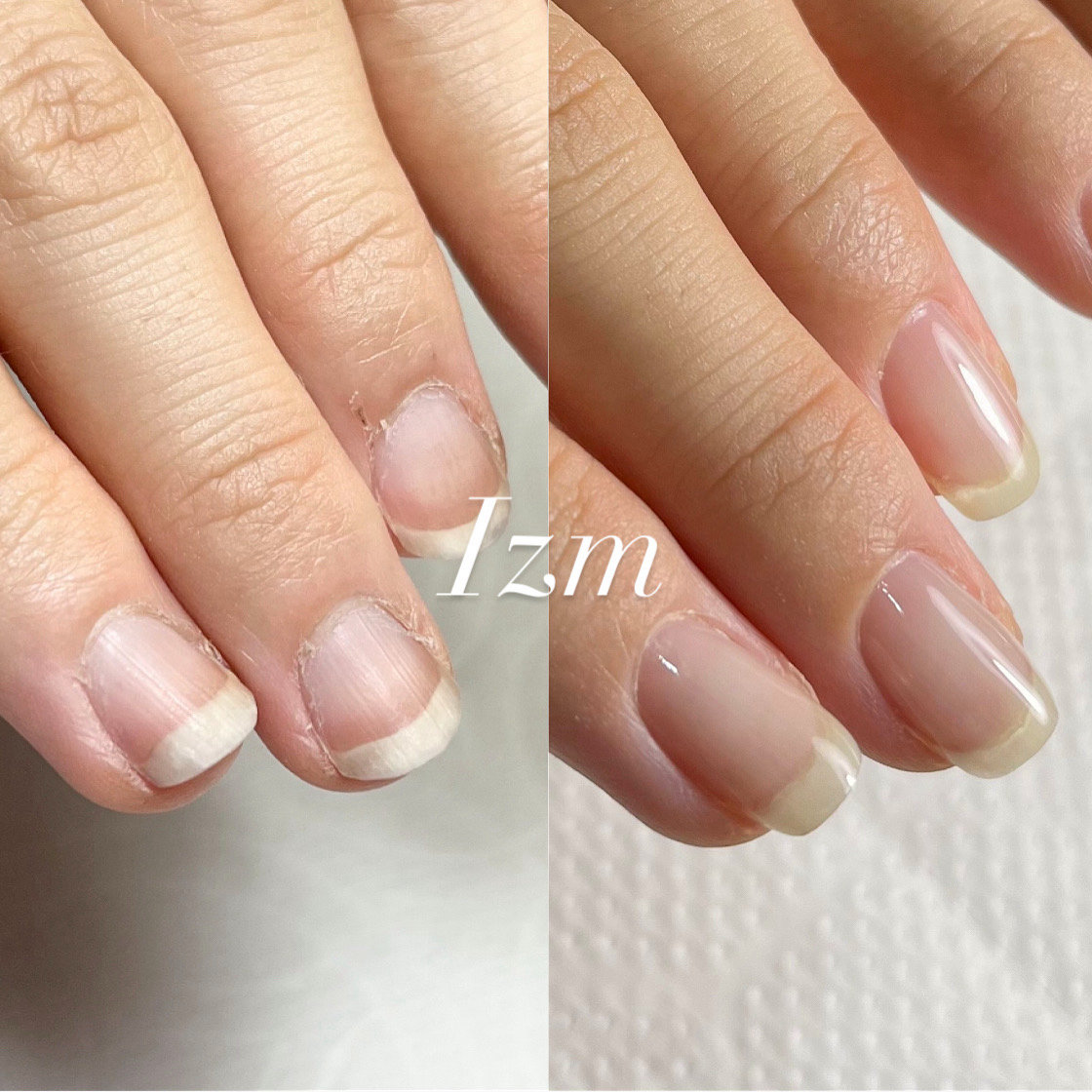nail_izm