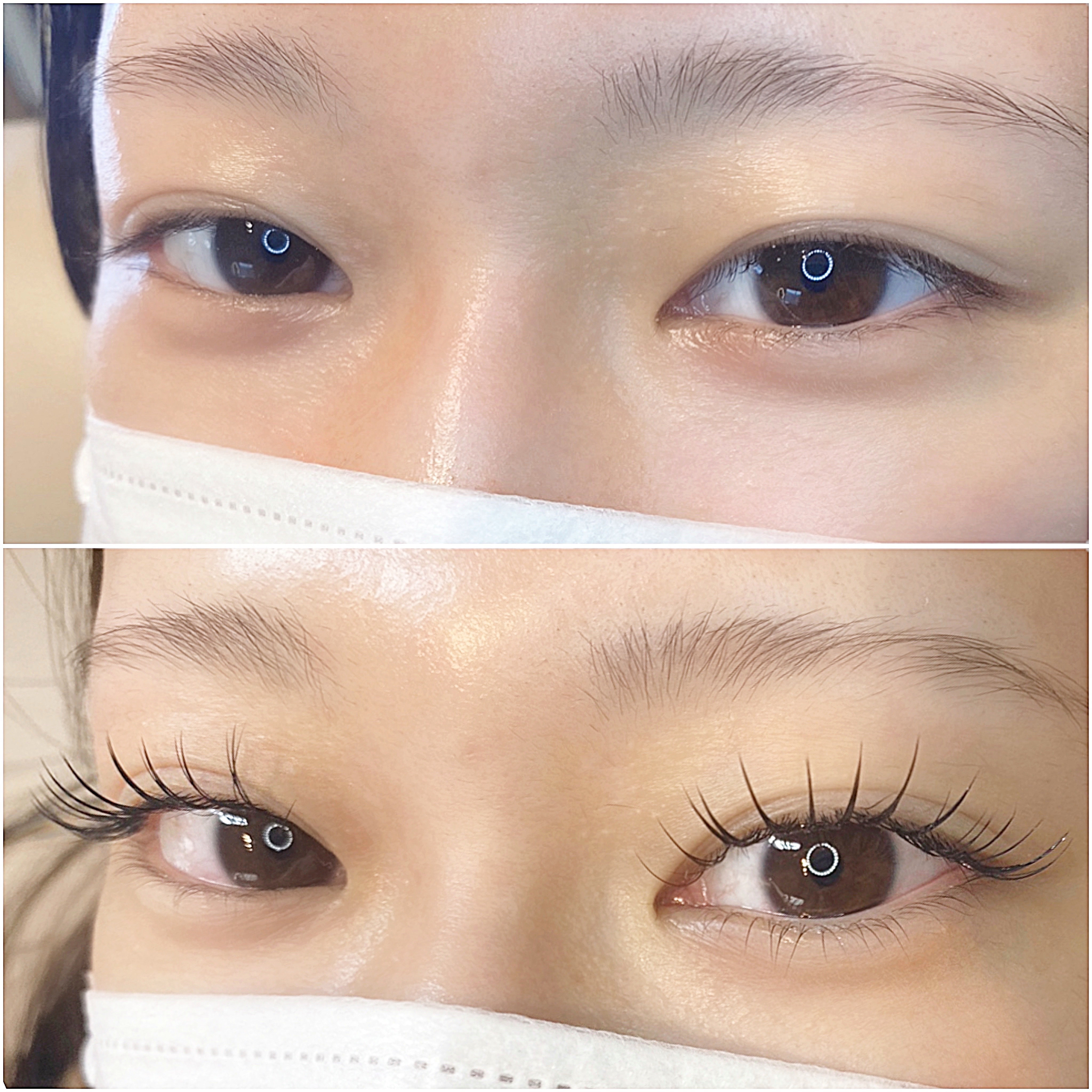 eyelist_aico