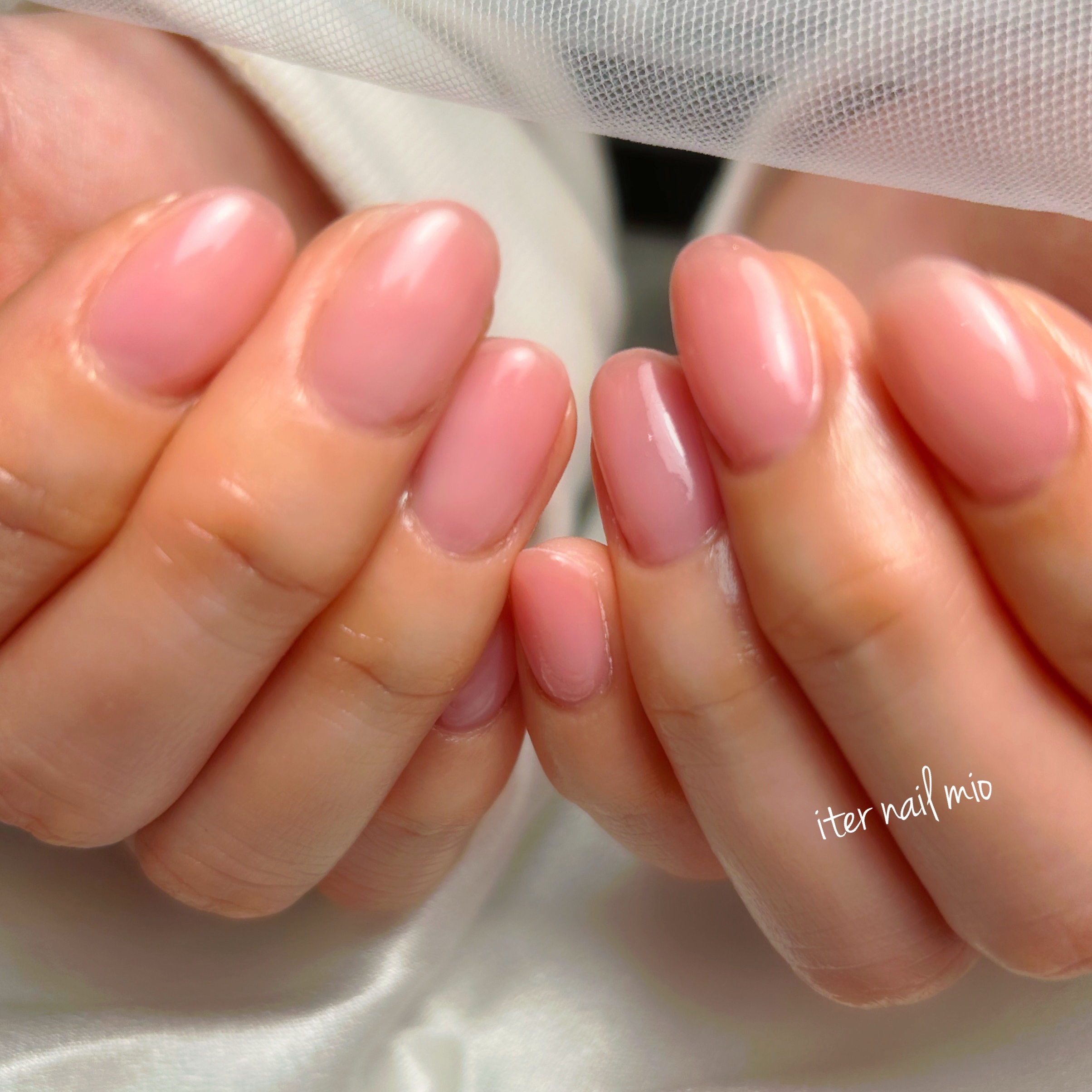 iter_nail_mio
