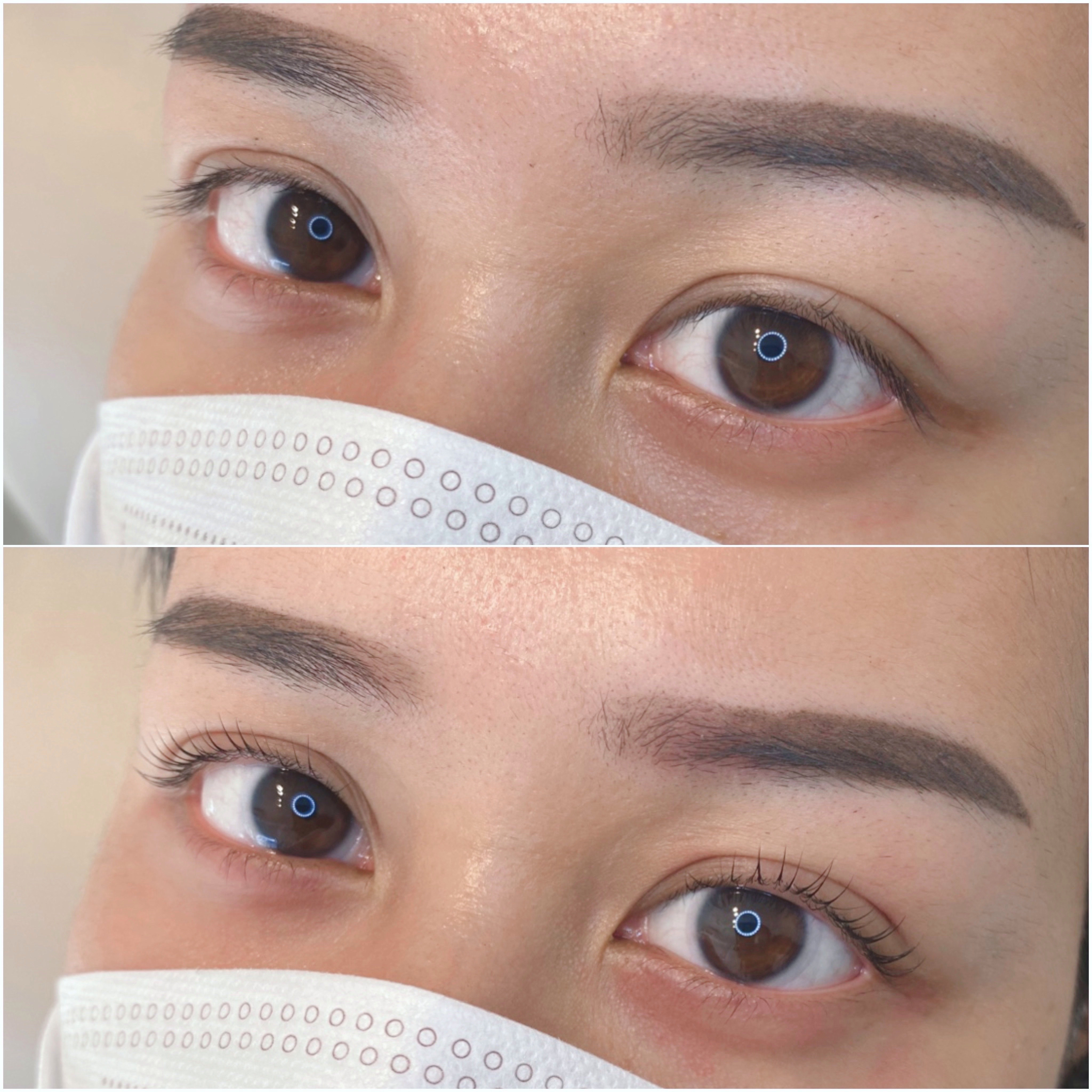 eyelist_aico