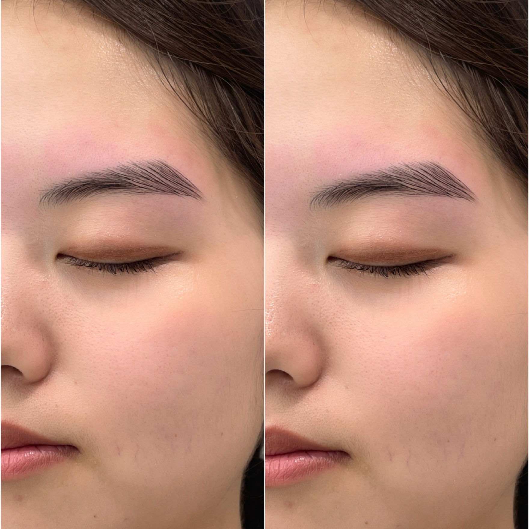 ode_eye