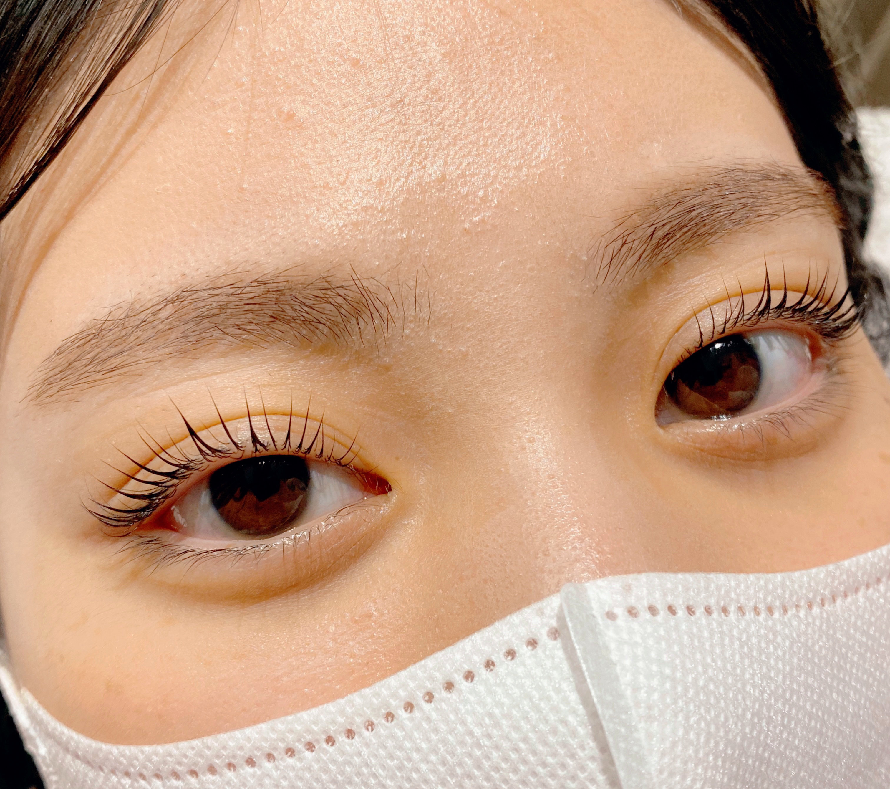 eyelist_aico