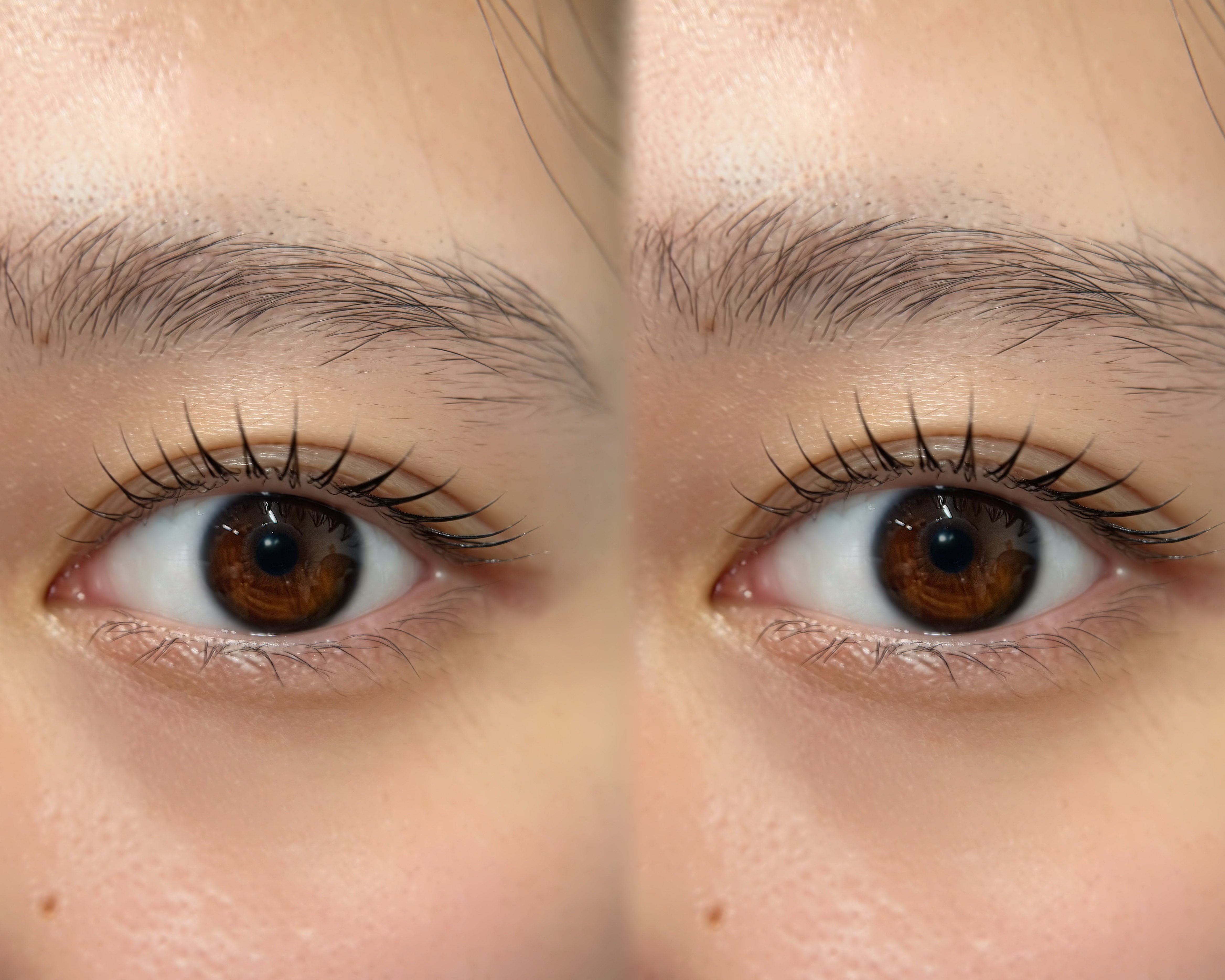 soome_eyeskin