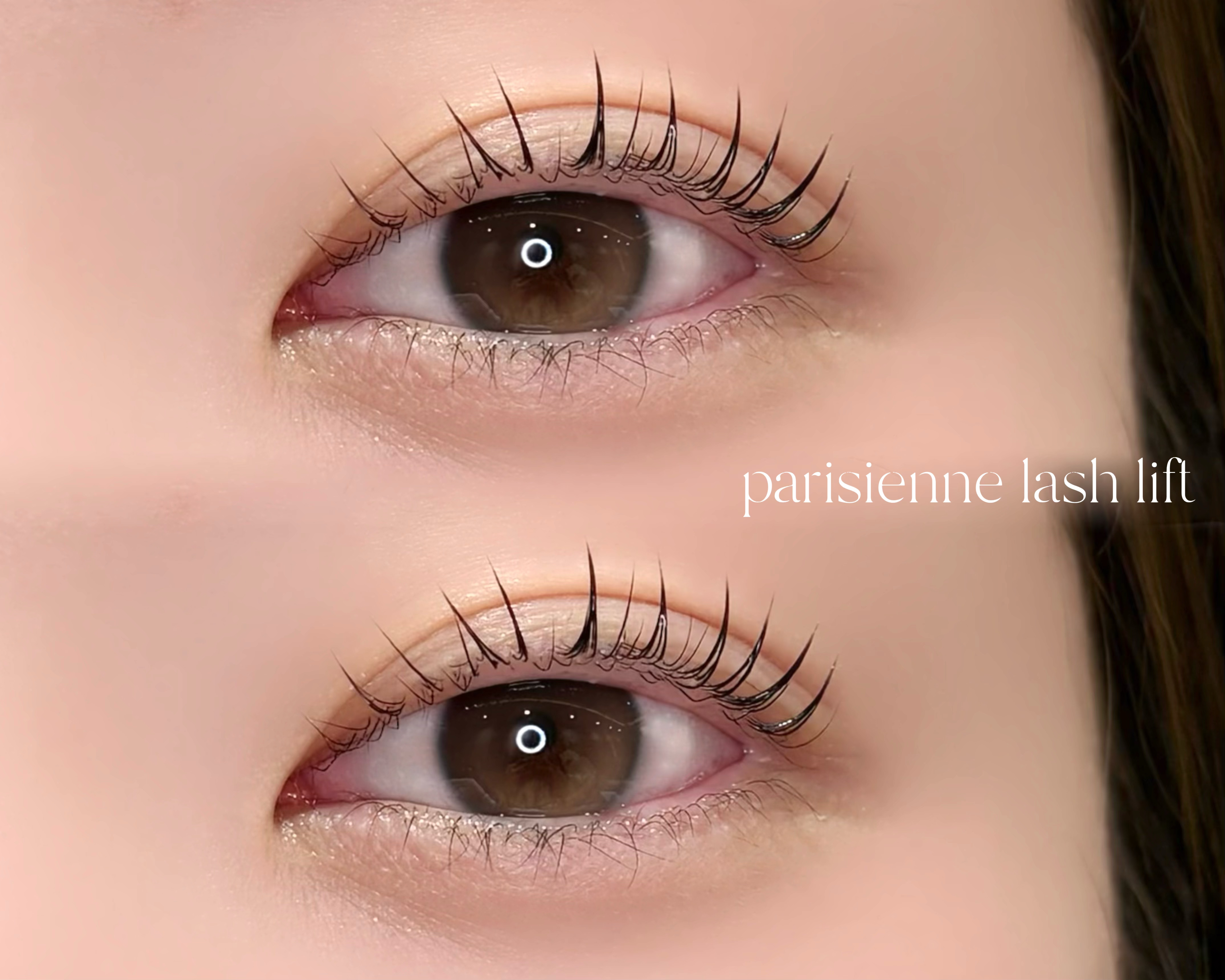 ym_eye_