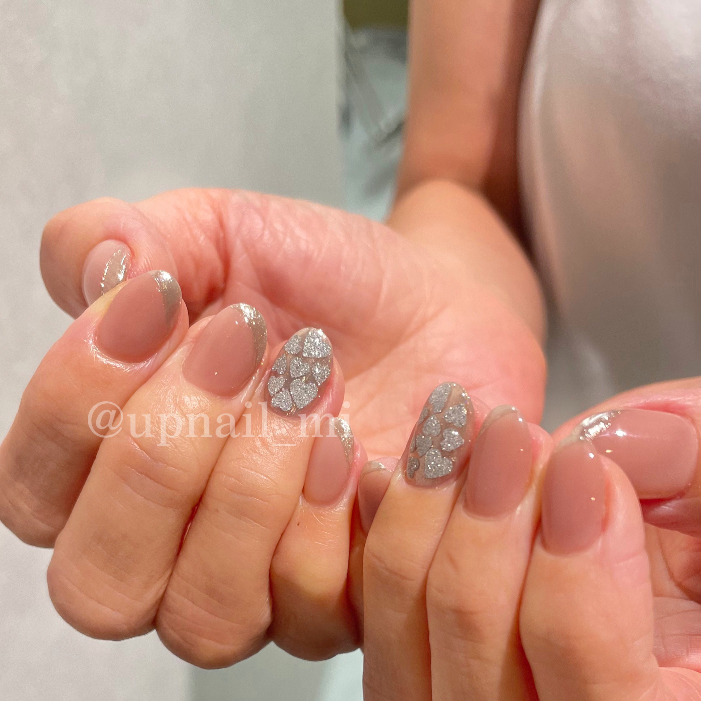 upnail_mi