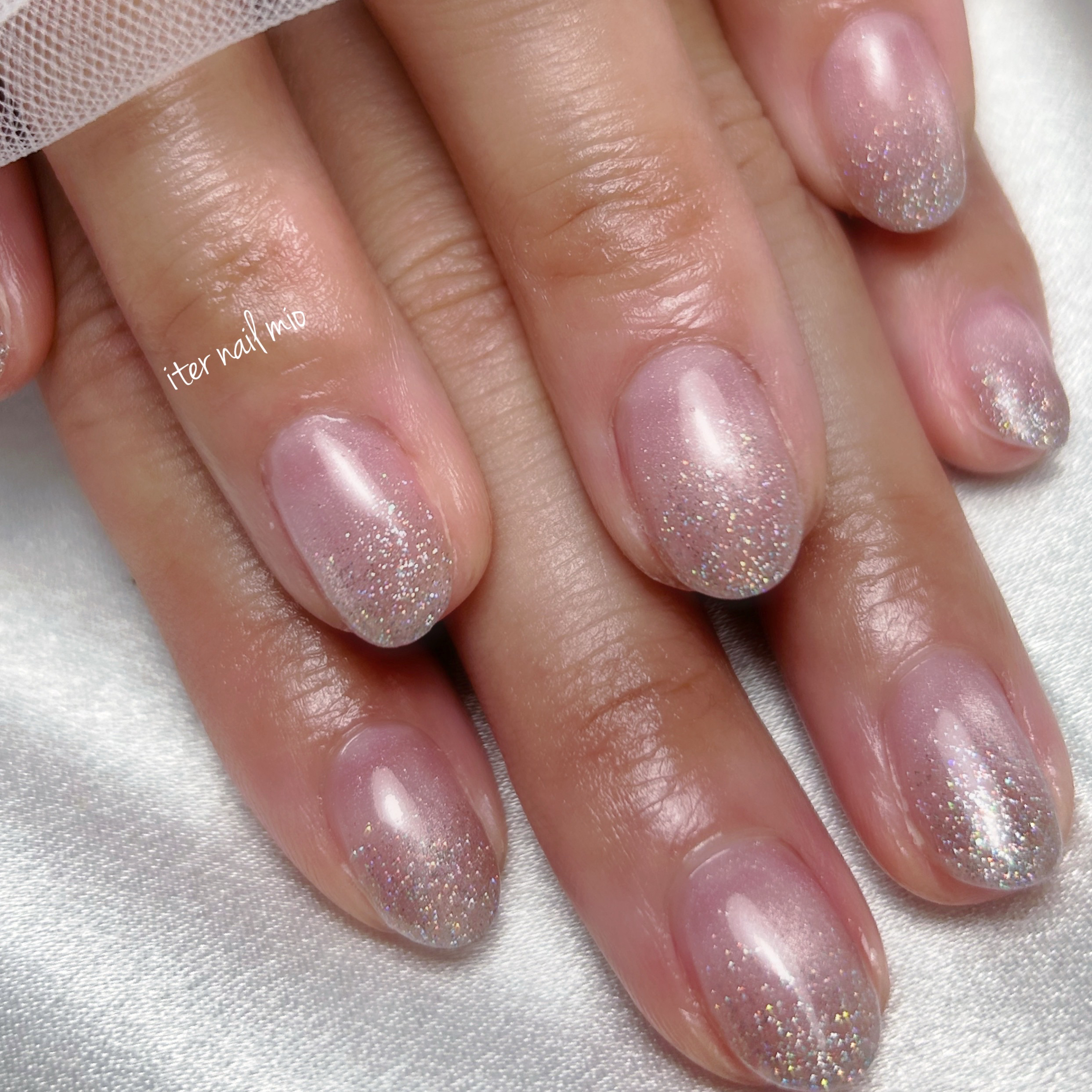 iter_nail_mio