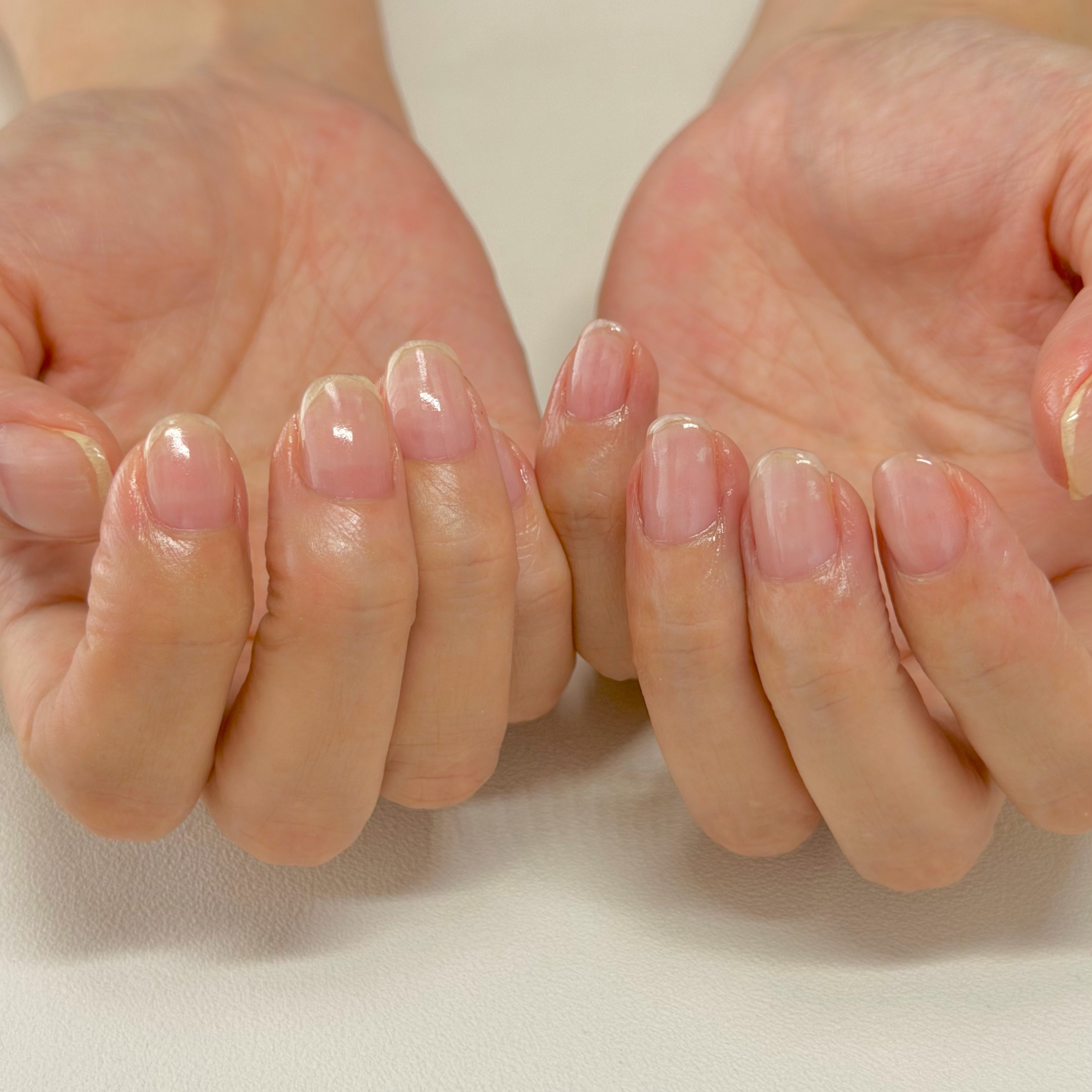 Nail__Lino